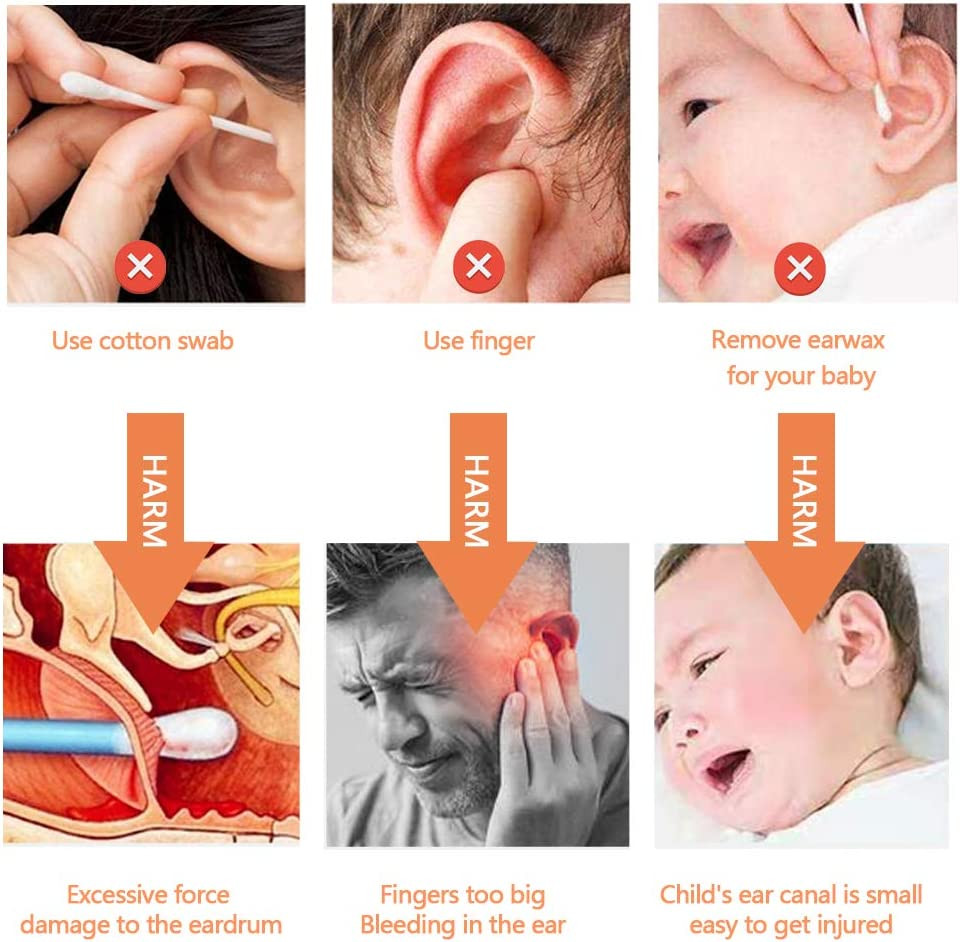 Curatator de urechi cu 16 capete spiralate de inlocuire EPILUM, silicon/ABS, alb/portocaliu