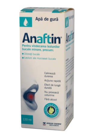 Aceasta este imaginea corespunzatoare acestui obiect